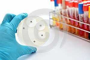 Antimicrobial susceptibility test