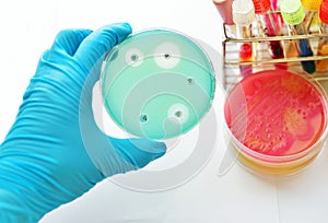 Antimicrobial susceptibility testing