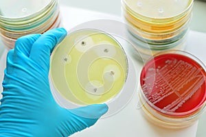 Antimicrobial susceptibility testing photo