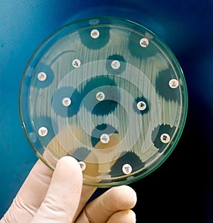 Antimicrobial susceptibility testing in petri dish