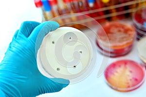 Antimicrobial susceptibility testing in petri dish photo