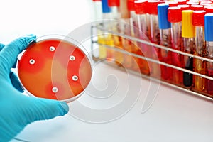 Antimicrobial testing photo