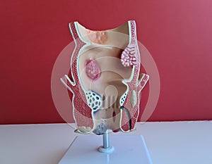 Anus anatomy. Treatment of diseases of rectum hemorrhoids