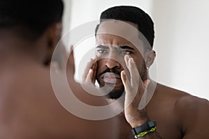 Anxious african american man worried about face wrinkles