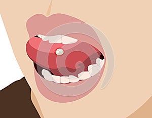 Aphthae or aphtha tongue close up, unhealthy in oral, illustration cartoon photo