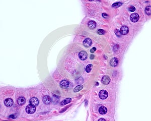 Apocrine sweat gland. Columnar epithelium