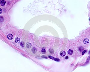 Apocrine sweat gland. Columnar epithelium