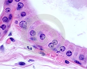 Apocrine sweat gland. Columnar epithelium