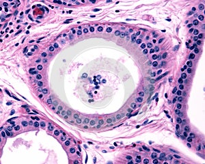 Apocrine sweat gland. Columnar epithelium