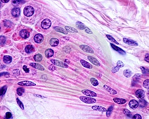 Apocrine sweat gland. Myoepithelial cells