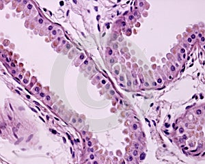 Apocrine sweat gland. Secretory unit