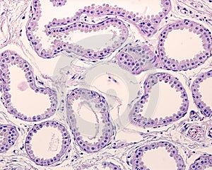 Apocrine sweat gland. Secretory unit