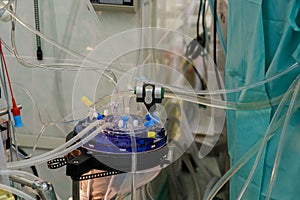 Apparatus circulation blood heart lung machine for heart surgery in operating room