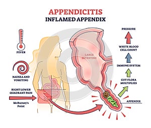 Appendicitis, inflamed appendix, abdominal problem diagnosis outline diagram photo