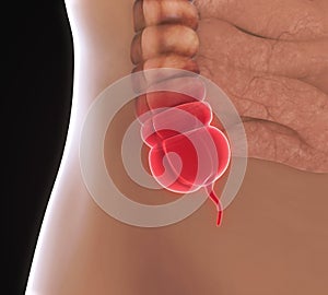 Appendix Pain Illustration photo
