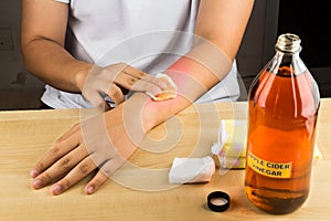 Apple cider vinegar effective natural remedy for skin itch, fung