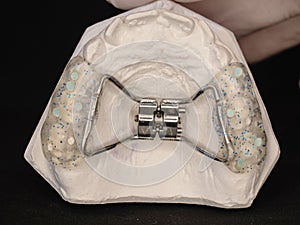 Appliance to make young upper jaw wider