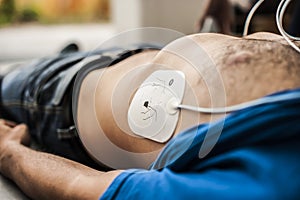 Application of defibrillation electrodes