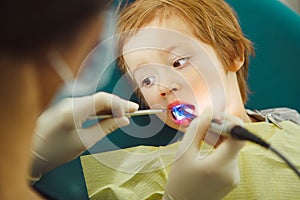 Application of ultraviolet fillings child. Patient little boy at dentist.