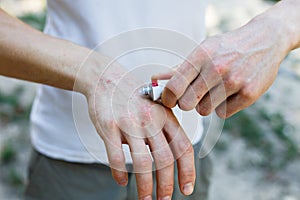 Applying an cream emollient to dry flaky skin as in the treatment of psoriasis, eczema and other dry skin conditions