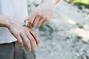 Applying an cream emollient to dry flaky skin as in the treatment of psoriasis, eczema and other dry skin conditions