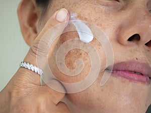 Applying cream treatment skin