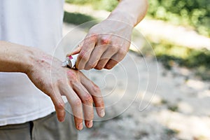 Applying an emollient to dry flaky skin as in the treatment of psoriasis, eczema and other dry skin conditions. White