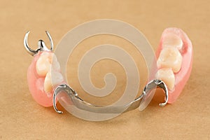 Arc dental prosthesis