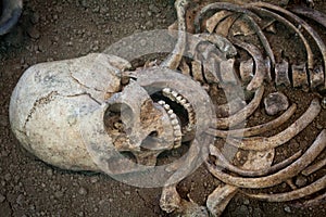 Archaeological excavations of an ancient human skeleton and human skull