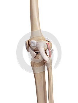 The arcuate politeal ligament