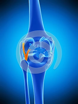 The arcuate politeal ligament