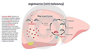 Arginase ARG1 Deficiency vector diagram illustration