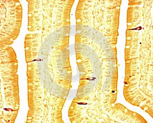 Argyrophilic cells in intestinal epithelium photo