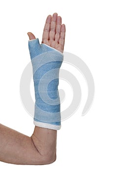 Arm in blue cast