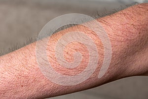 Arm hair of human are goosebump when the weather is cool or winter season