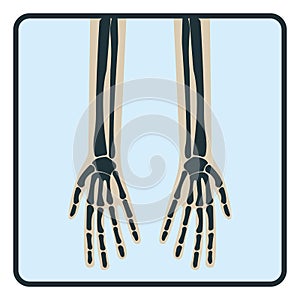 Arm hand bone, x-ray concept icon, roentgen human body image isolated on white, flat vector illustration. Skeleton part of man photo