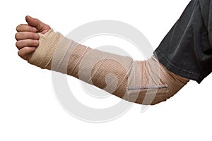 Arm splint