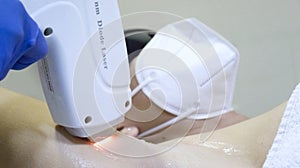 Armpit laser hair removal