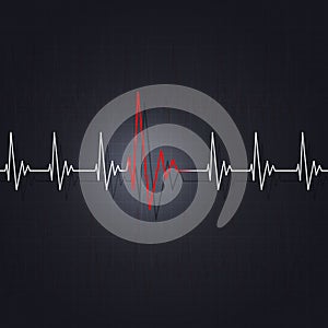 Arrhythmia of a Heart photo