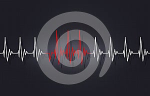 Arrythmia Irregular Heartbeat Illustration