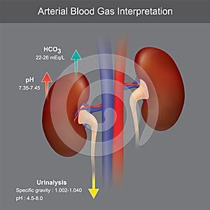 Arterial Blood Gas Interpretation. Illustration photo