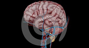 Arterial Supply to the Brain