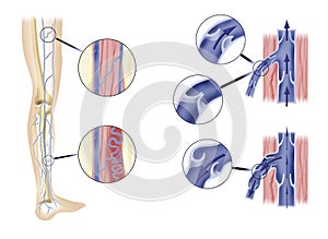 Arteries in leg