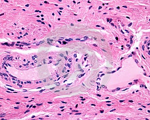 Arteriole and venule