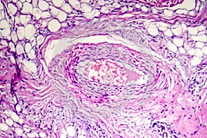 Artery inside adipose tissue photo
