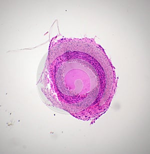 Artery section under the microscope