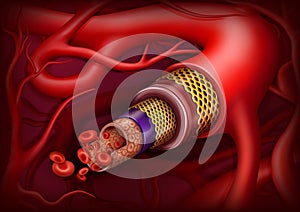 Artery structure. Vector ilustration