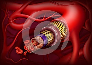 Artery structure. Vector ilustration photo