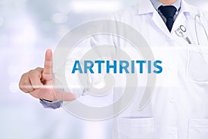 ARTHRITIS