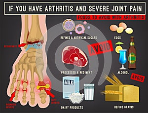 Arthritis foods image